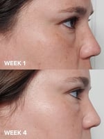 محلول مقشر 2% بي اتش اي لاعادة توازن البشرة من باو...