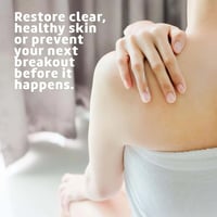 دي لا كروز مرهم الكبريت لعلاج حب الشباب 73.7جم