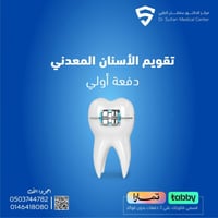 تقويم الأسنان المعدني