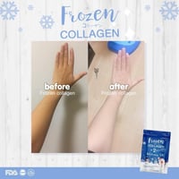 كبسولات فروزن كولاجين للتبيض