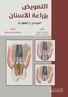 التعويض بزراعة الأسنان المبادئ والخطوات