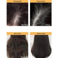 شامبو ساكورا الياباني لتعزيز نمو الشعر من ماكسفيت...