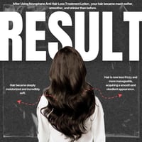 ايه سي ام نوفوفان لوشن لتساقط الشعر 100مل