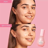 جلو ريسيبي سيروم البطيخ لنضارة و تفتيح البشرة بخلا...