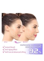 مشد الوجه حزام تنحيف طبي بعد عملية شفط اللغلوغ وال...