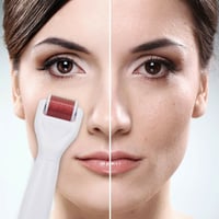 ديرما رولر - مجموعة ديرما رولر 4 في 1 الشكل الجديد