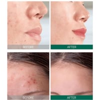 سوم باي مي - مجموعة ميراكيل تقشير و تفتيح و ترطيب...