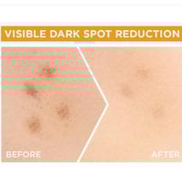 غارنييه - سيروم للوجه سكين اكتيف إشراقة سريعة فيتا...