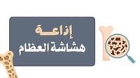 إذاعة عن هشاشة العظام