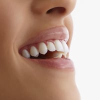 ملمع الأسنان