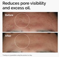 نياسيناميد 10% + زنك 1% من ذا اورديناري - 30مل