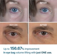 دكتور ميلاكسين‏, Eyephalt ، كريم العينين لإكياس ال...