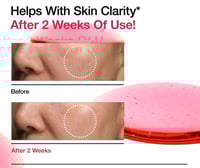 أنوا سيروم نياسيناميد 10 +TXA 4-30ML