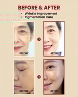 سيروم سيول 1988 بالريتينال والجينسنغ الأسود من كي...