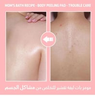 ليفة تقشير الجسم الكورية الوردية تروبل كير للبشرة...