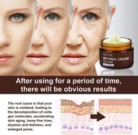 كريم ريتينول المضاد للشيخوخة لشد البشرة مع حمض اله...