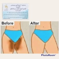 صابون تفتيح الوجه والجسم والمناطق الحساسة ساره بيو...