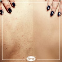 بياري - صابونة الكركم