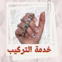 خدمة تركيب التشارمز