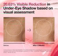 منظفات قطنية بخلاصة النياسيناميد 5% وحمض الترانكسا...