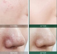 سوم باي مي كريم ميراكل 30 يوم المعزز بالأحماض - 60...