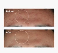 مجموعة الإصلاح والتوازن للبشرة