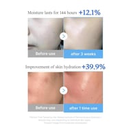 ميديكيوب سيروم بحمض الهيالورونيك والبيبتيدات المتع...