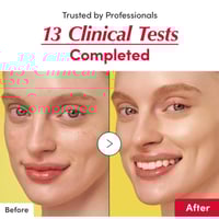 مجموعة ثقة البشرة من إيكوال بيري