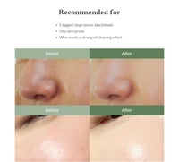 منظف سريع لتنظيم الدهون وإزالة الرؤوس السوداء من د...