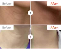 دكتور ميلاكسين كريم العناية بالرقبة نيكسفالت بالسي...