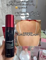 مجموعة لولين للتفتيح والتنقية الذكية