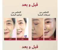 مجموعة ثنائي الإشراقة الكورية