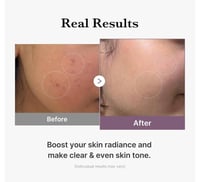 ميديكيوب تونر جلوتاثيون للتفتيح والتوهج 140مل