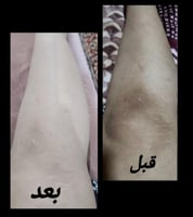 كريم وآيت بلس لتفتيح مضاعف وترطيب+ عبوه ثالثه هديه