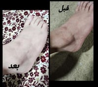 كريم وآيت بلس لتفتيح مضاعف وترطيب+ عبوه ثالثه هديه