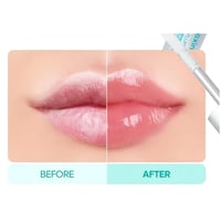 فيلر شفاه بي بي سبايكيول من دكتور ميلاكسين - 4مل