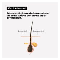 ماسك شعر سكالب أدفنسد من لوريال بروفيشنال - 250مل