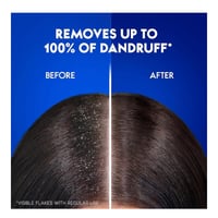 شامبو شعر انتعاش الليمون ضد القشرة من هيد اند شولد...