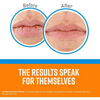 مرطب الشفاه لإصلاح الشفاه من اوكفيز - 4.20جرام