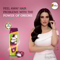 شامبو شعر بالبصل من فاتيكا - 400مل