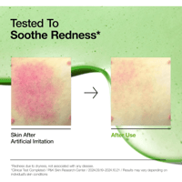 سيروم أزيلايك أسيد 10+هيالورون لبشرة هادئة ومشرقة...