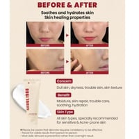 سيول 1988 غسول رغوي منظف للبشرة خلاصة الصنوبر والب...