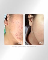 مجموعة لوكس اورغانيكس العلاجية لتبييض وترميم البشر...