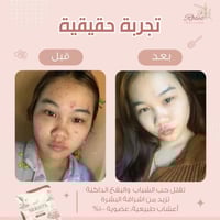 صابونة التفتيح للوجه من نيريستا - Nerista Face Soa...