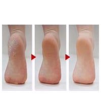 جوارب تقشير القدمين السحرية من ام بيوتي