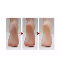 جوارب لتقشير القدمين المكثفة من ام بيوتي