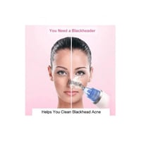 جهاز تنظيف الرؤوس السوداء من اوكيما - OK-457