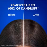 Head & Shoulders CLASSIC CLEAN Shampoo 390ML