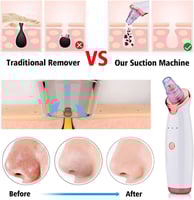 جهاز إزالة الرؤوس السوداء 5 في 1 H 301