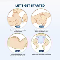 كريم مهدأ للحكة مغذي وصديق للبشرة الطفل 50مل